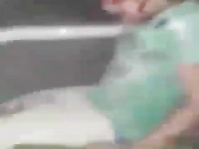 Screaming that he lost his leg and his father