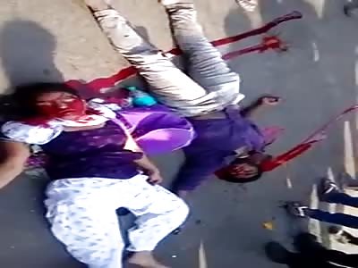 Poor Girl ... Gasping Blood Gurgling Moments After Horrific Accident 