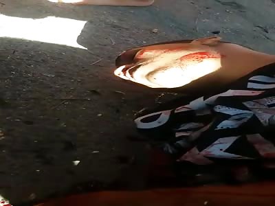 Young 22 years old. with firearm shots giving their last breaths of life