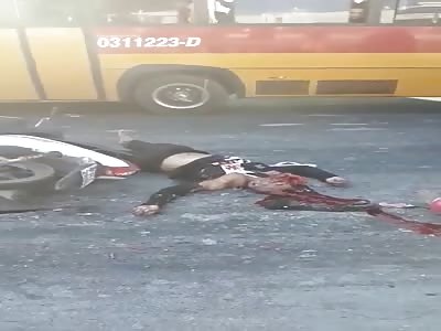 Gruesome Aftermath of his HEAD after being Crushed to a Mangled Mess