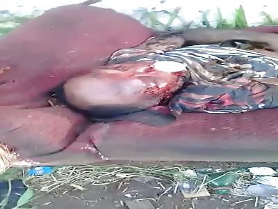 in icoaraciÃ£o BRAZIL that dead man with several piercings by the body ...