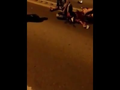 ACCIDENT LEAVES THE DESTROYED LEG