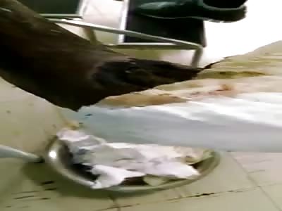 WTF  foot completely rotten and full of worms