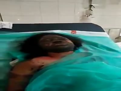 Husband Dew acid all over his body to his own wife