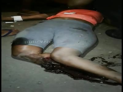 Accident victim loses his torn leg