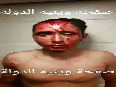 This is what the supporters of prostitution and the hashish party are 