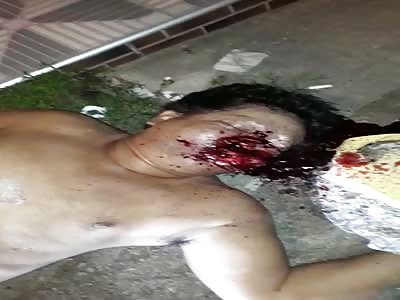 Guy with Smashed Mouth and Destroyed Face(Still Alive)