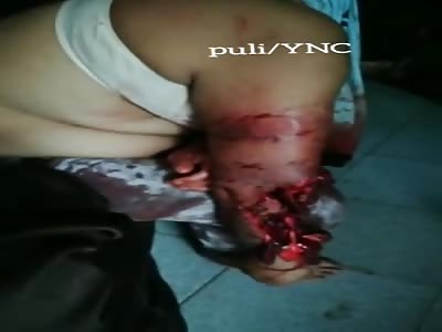 Woman suffers from pain