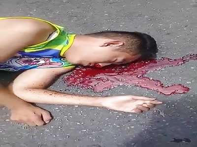 Dying Young Man Performs Agonal Breathing