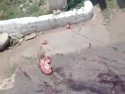 Head Sliced In Half & Brain Turned Into Flapjack After Accident