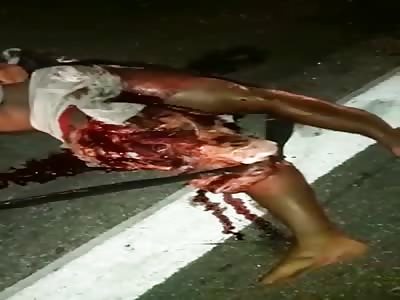 BRUTAL ACCIDENT LEAVES MAN WITH LEGS DESTROYED