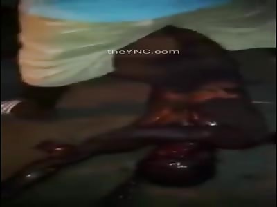 Severely Burned Man Dragged , Beaten and Mutilated with Machete 