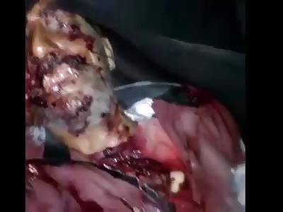 Man with broken head after accident