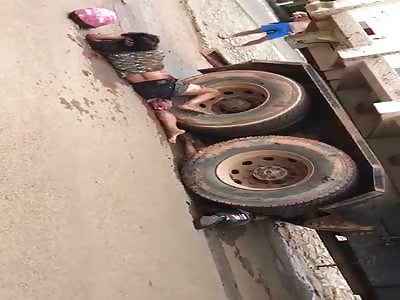 Woman in agony after losing her leg in accident