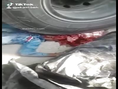 Kid Left on Road Severely Crushed by Huge Truck