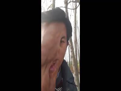 malformation on the face