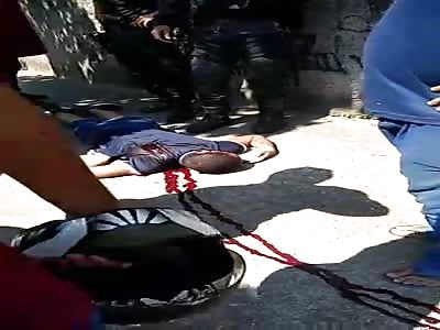 Thief in agony after receiving shot