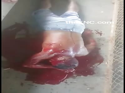 Man in Extreme Agony After Gets a Gun Shot to Head