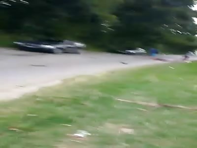 brutal accident leaves the leg shattered