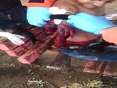  Man with Arm Ripped off by Train is in a Complete State of Shock 