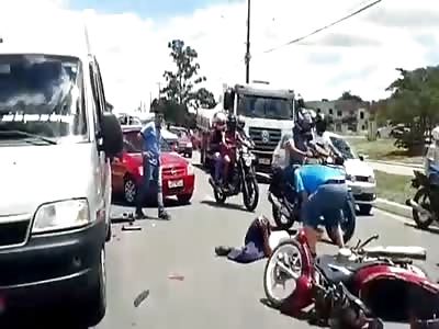 Elastic man,  horrific accident with man