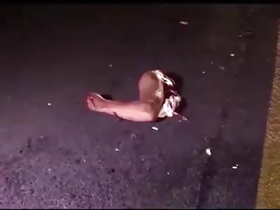 GRAPHIC: Man has Arm Torn off of Shoulder Blade....