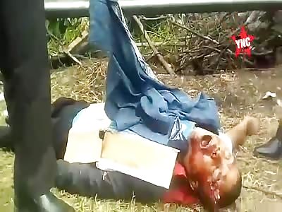 Couple hit by truck in the road