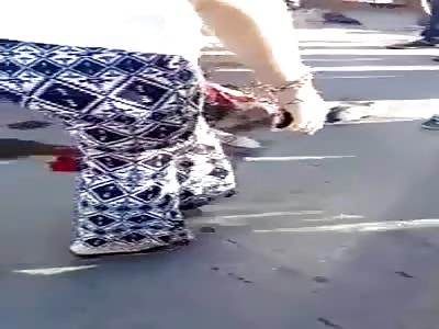 shit! Man with legs smashed after accident