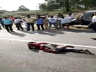 brutal accident leaves legless man