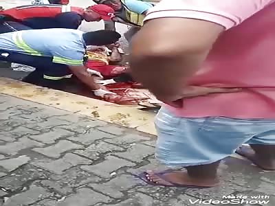 Leg Fucked up showing Tendons and Muscles