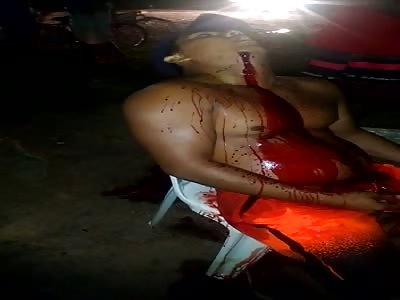 Disturbing Aftermath of a Neck Shot