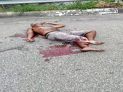 World of PAIN: Terrible Injury to a Motorcyclist Leg after Overturning.