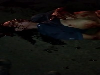 Skin Ripped Off Manâ€™s Body 