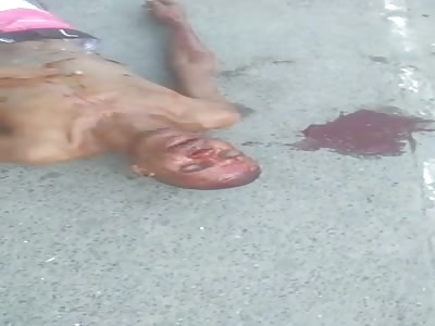 Man agonizing after Shots