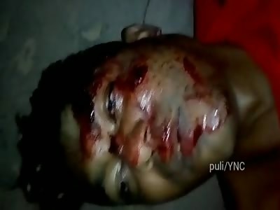 Brazil....Man shot to death