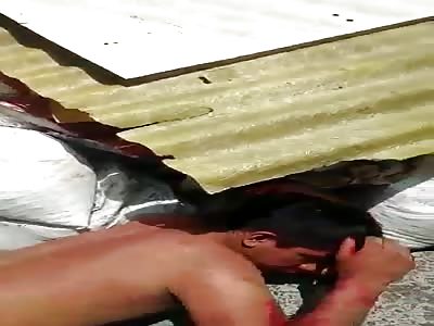 STICKED A LADY INTO THE LEG TO ASTONISH HER THEY STOOD AND HIT