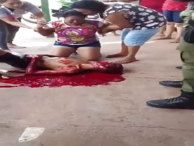 Still Alive With a Bullet in His Head.