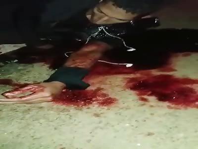 Motorcyclist Almost Decapitated on Fishing Wire Strung Across the Road