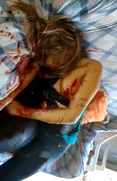 Madman Leaves Knife Mark in Ex-Girlfriend's Body