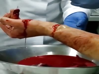 A police officer while carrying out an arrest warrant injured his hand