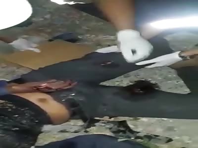 Man in agony after accident