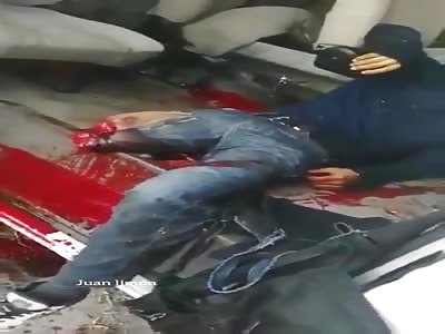 Fully Aware Biker Has No Option to Stand on