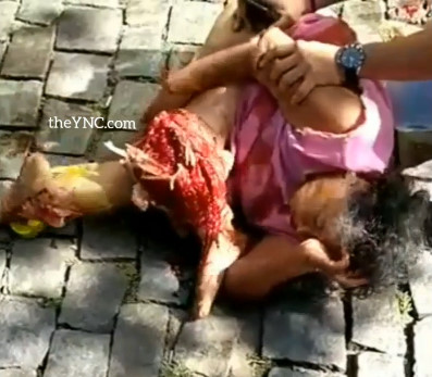 Hey Grandma , You Want Your Leg Back?