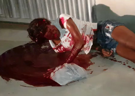 Resting in a Sparkling Pool of Blood