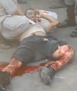 No Legs and Nerves of Steel..