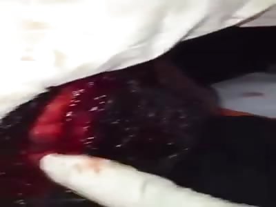 Man's Head Sliced open During Brutal Machete Fight.