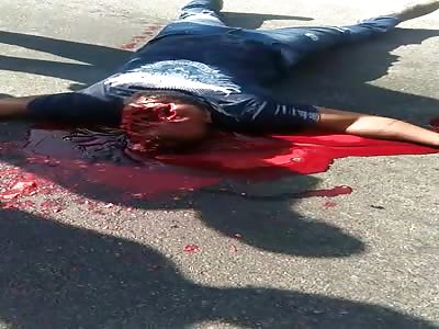 Shocking accident, msm have own face ripped