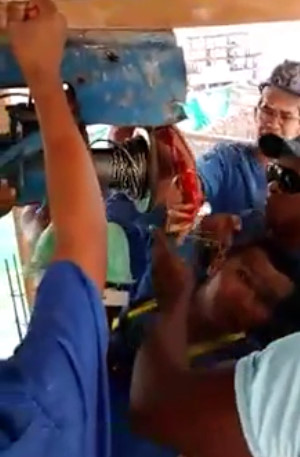 Dude`s Hand is Fucked Up in Grinder