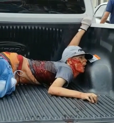 Garbage Dumps Still Growing in Brazil