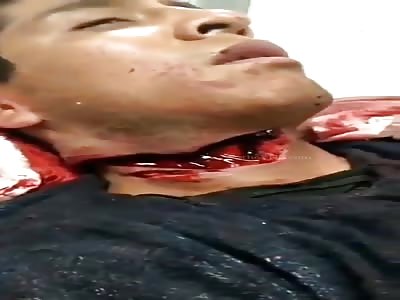 Throat Sliced in the Subway